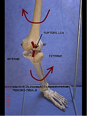 rotation externe