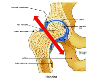 fracture du col