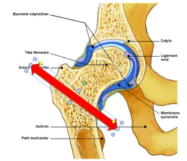 clou centromedullaire